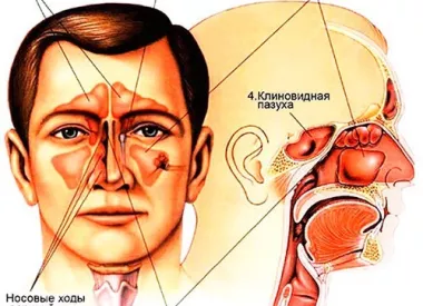 Пазухи носа