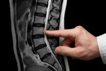 Снимок МРТ поясничного отдела позвоночника