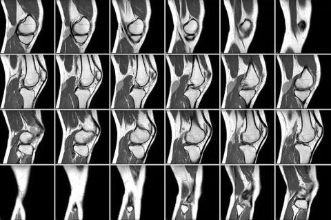 Снимок МРТ суставов