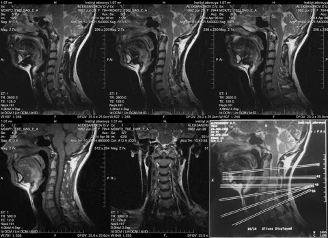 Снимок МРТ тканей шеи